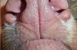 Cleft of the lower alar nasal folds